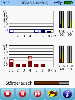 Senti & Sentiero TEOAE - Kalibrierung
