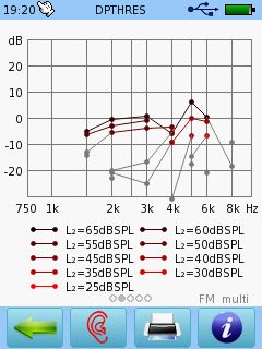 Senti & Sentiero TEOAE-Diagnostik Messung
