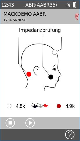 QScreen AABR-Impedanzprüfung