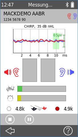 QScreen - AABR-Messung (binaural)