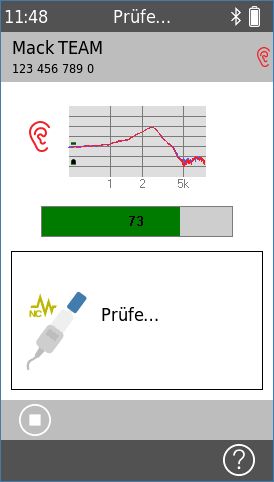 Qscreen TEOAE - Kalibrierung