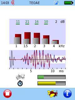 Senti & Sentiero TEOAE - Diagnostik Messung