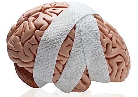 BERTEC: COBALT Concussion Management