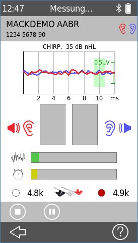 QScreen AABR Messung (binaural)
